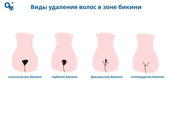 kak sdelat rezkie zony bolee myagkimi