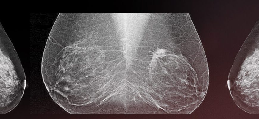 kak vizualizirovat rezultaty vyborov v raznyh stranah